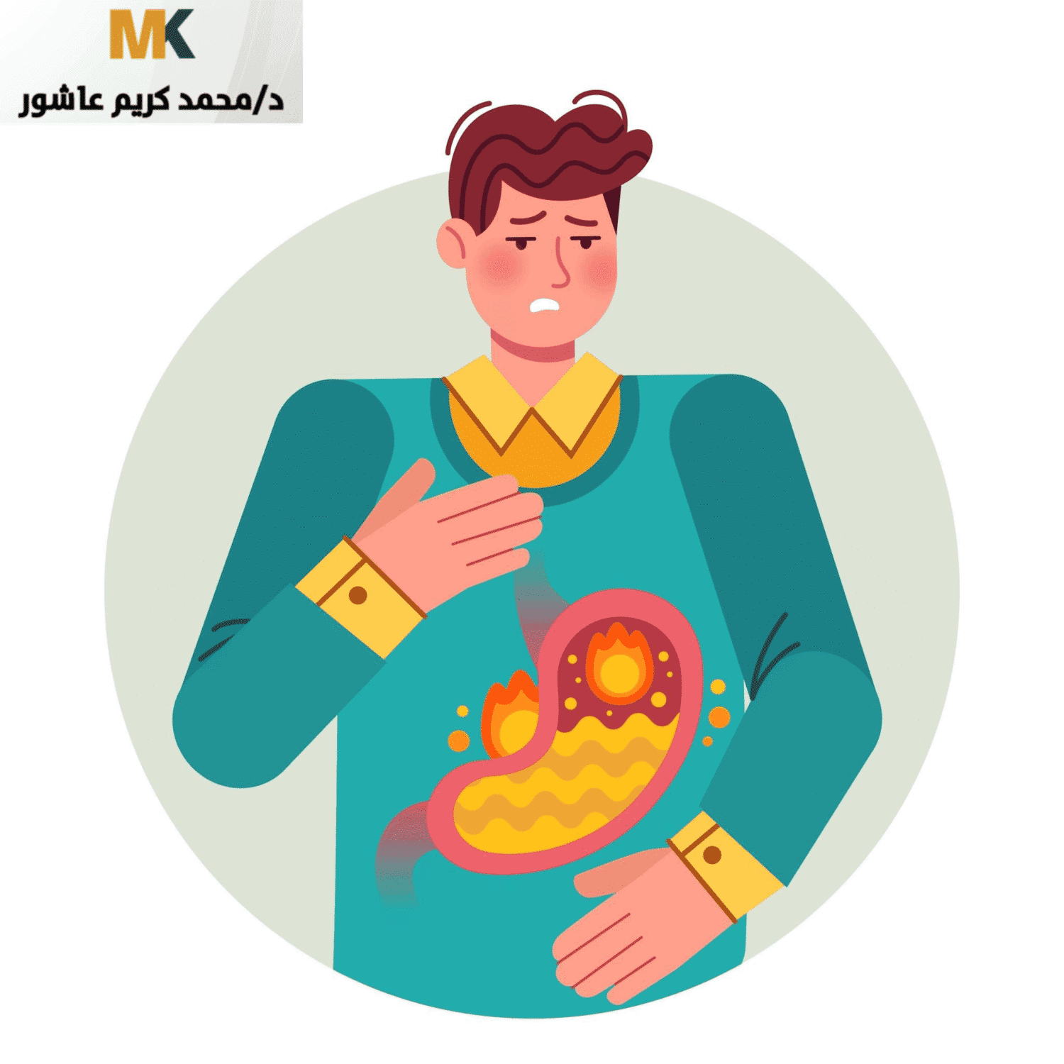 عملية GERDx - تجربتي مع عملية ارتجاع المرئ