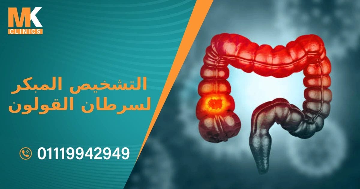 افضل دكتور التشخيص المبكر لسرطان القولون في مصر