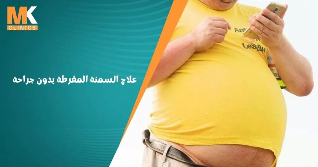 علاج السمنة المفرطة بدون جراحة