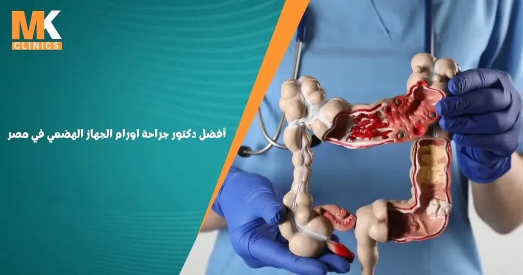 أفضل دكتور جراحة اورام الجهاز الهضمي في مصر