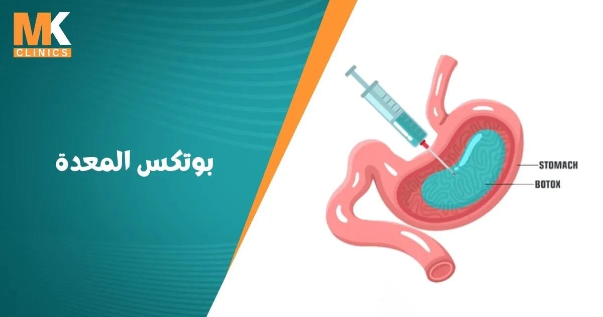 بوتكس المعدة