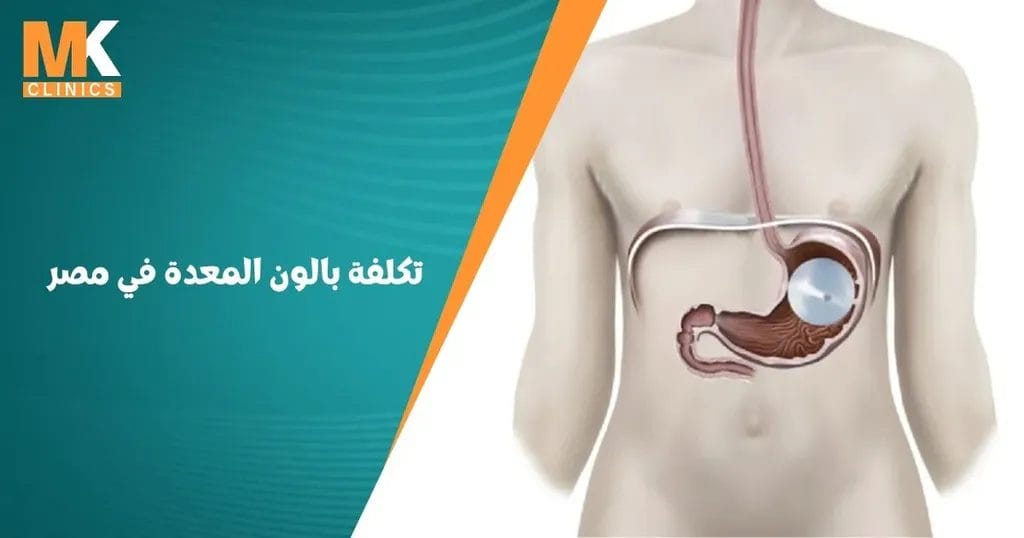 تكلفة بالون المعدة في مصر