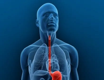 علاج التهاب اسفل المريء