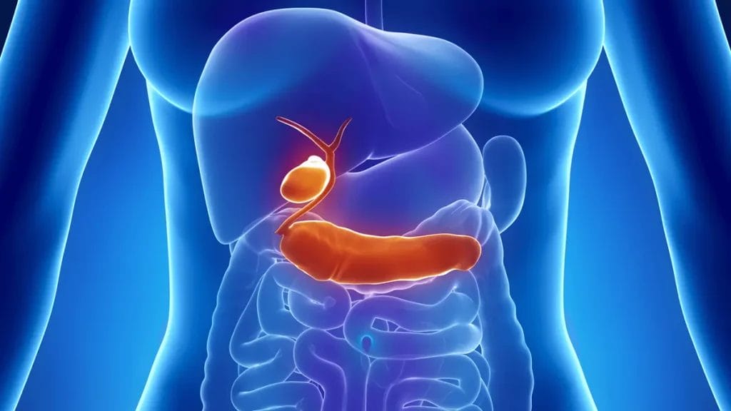 علاج انسداد القناة الصفراوية