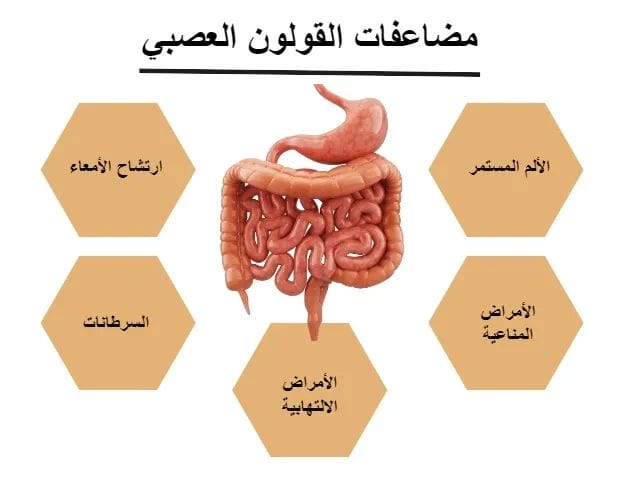 اقوى علاج للقولون العصبى: علاج القولون العصبي للابد 5 مضاعفات القولون العصبي