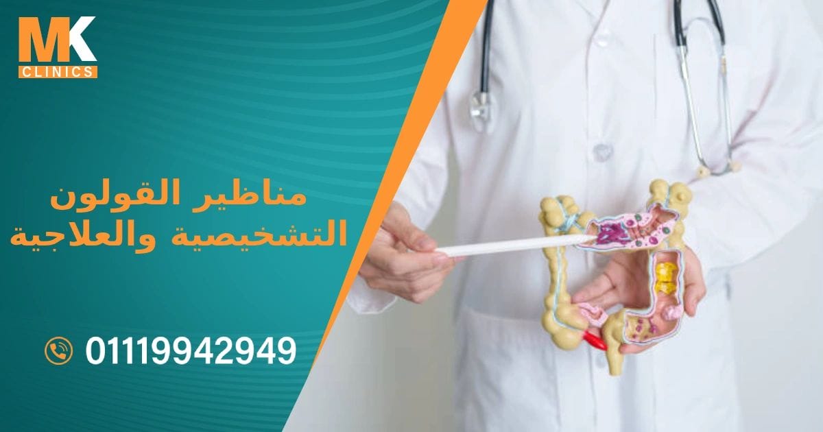 دكتور مناظير القولون التشخيصية والعلاجية في مصر الجديدة 2024
