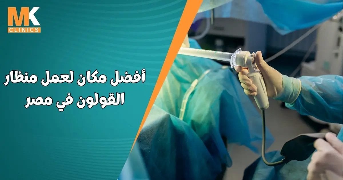 أفضل مكان لعمل منظار القولون في مصر