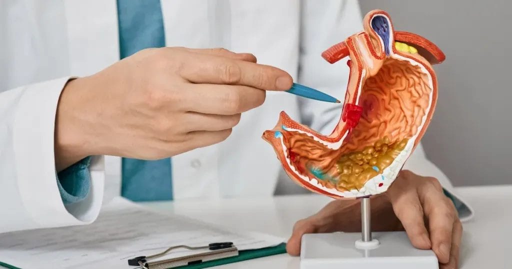 كورس علاج جرثومة المعدة