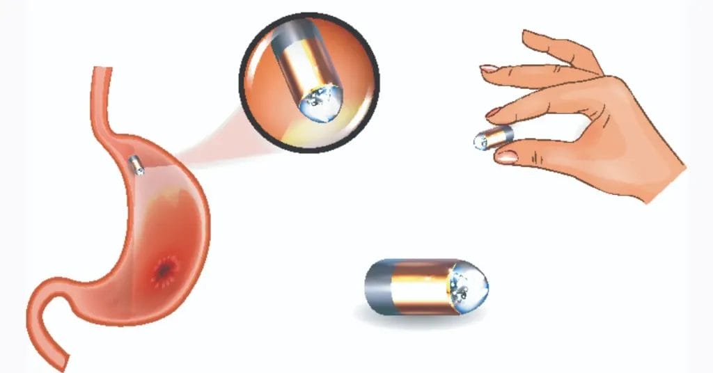 سعر منظار الأمعاء الدقيقة