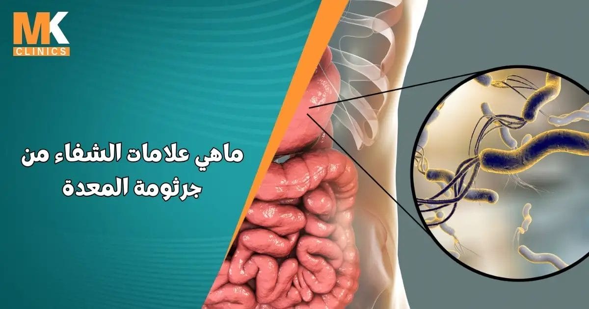 ماهي علامات الشفاء من جرثومة المعدة
