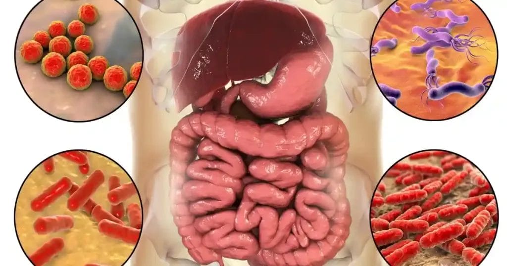 أعراض ما بعد علاج جرثومة المعدة
