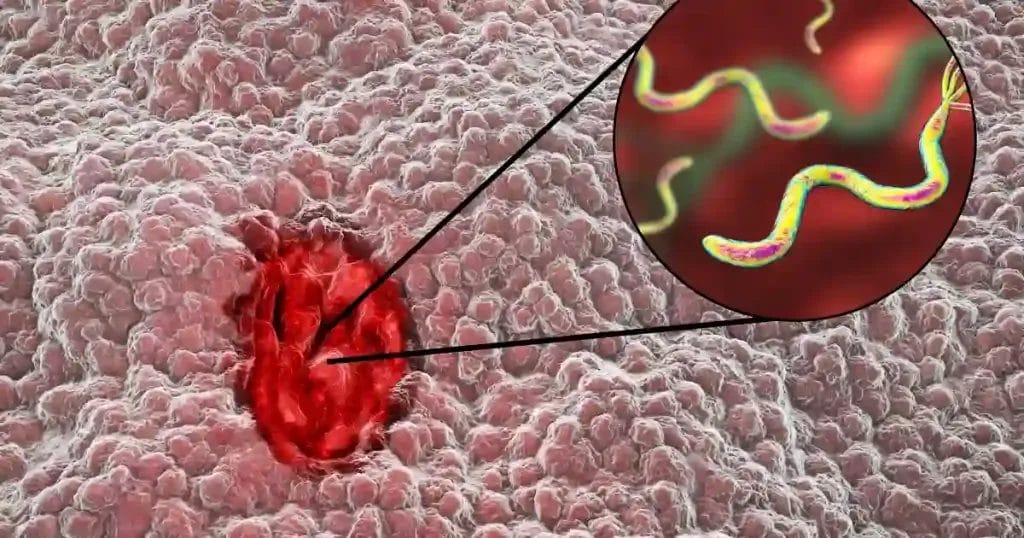 متى تموت جرثومة المعدة
