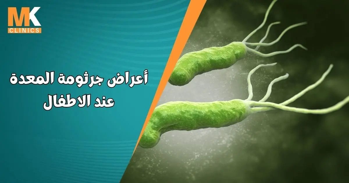 جرثومة المعدة عند الاطفال