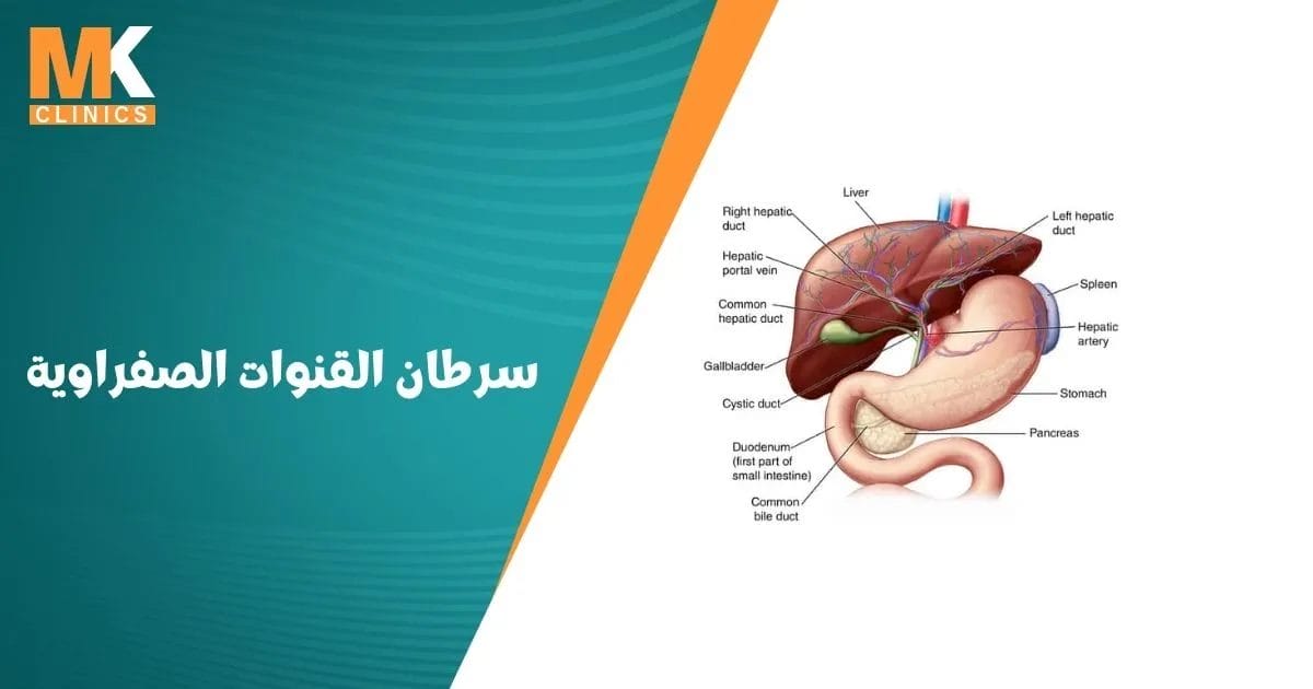 سرطان القنوات الصفراوية