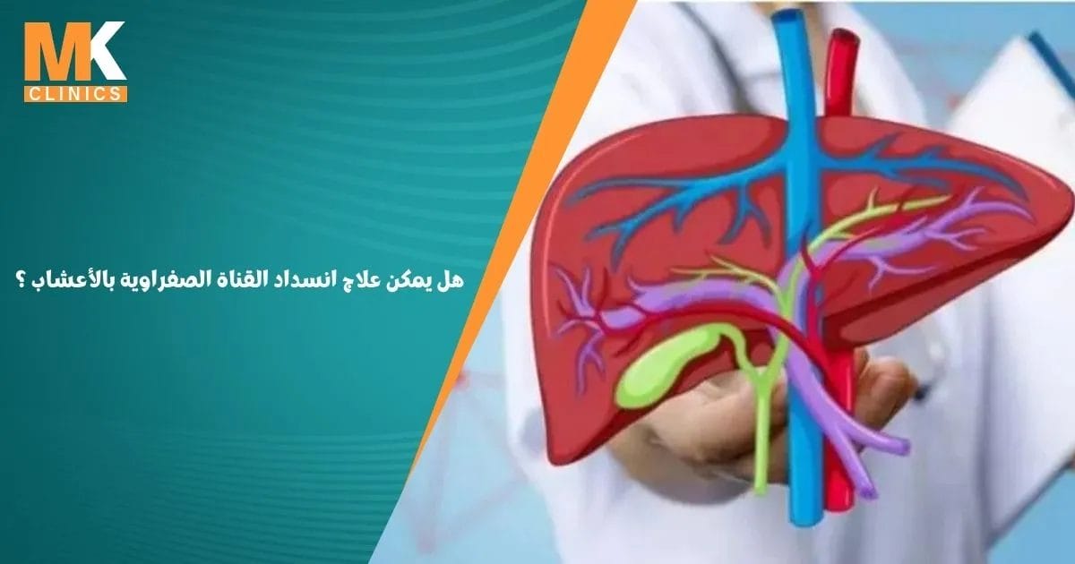 هل يمكن علاج انسداد القناة الصفراوية بالأعشاب ؟