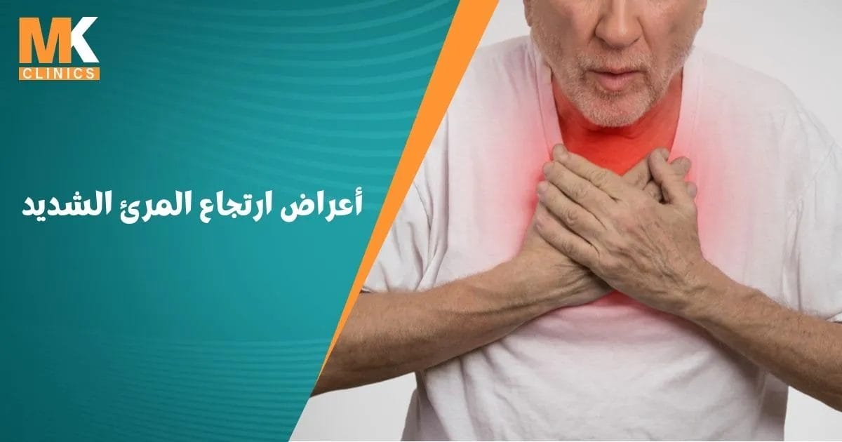 أعراض ارتجاع المرئ الشديد