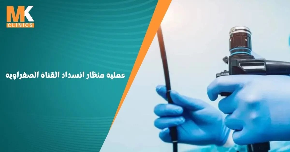 عملية منظار انسداد القناة الصفراوية