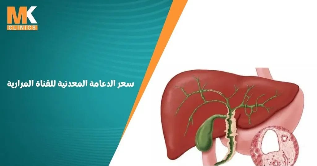 سعر الدعامة المعدنية للقناة المرارية