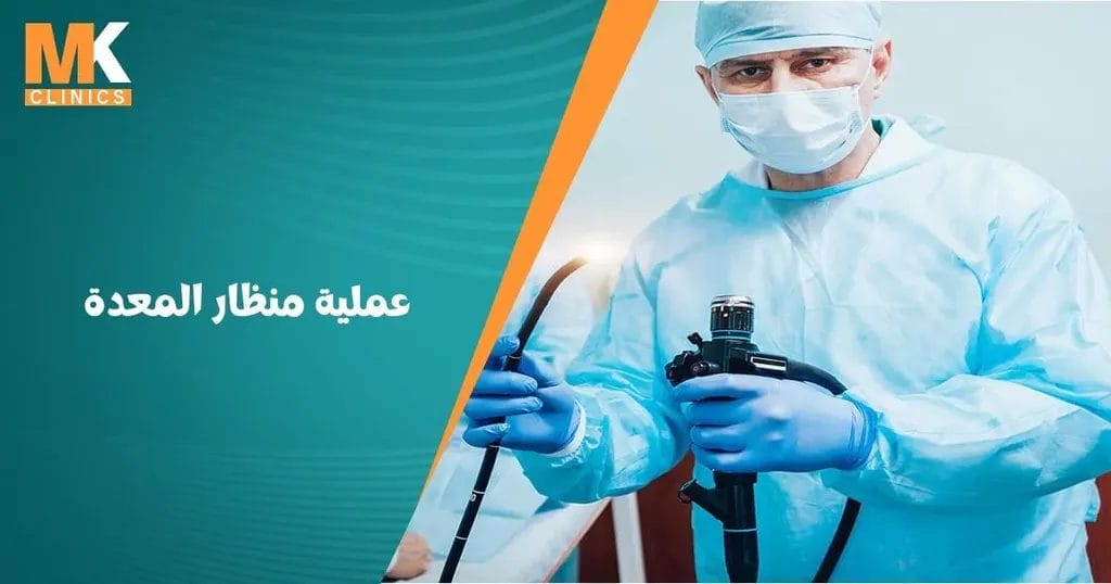 عملية منظار المعدة