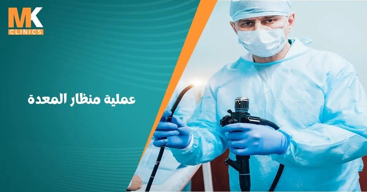 عملية منظار المعدة