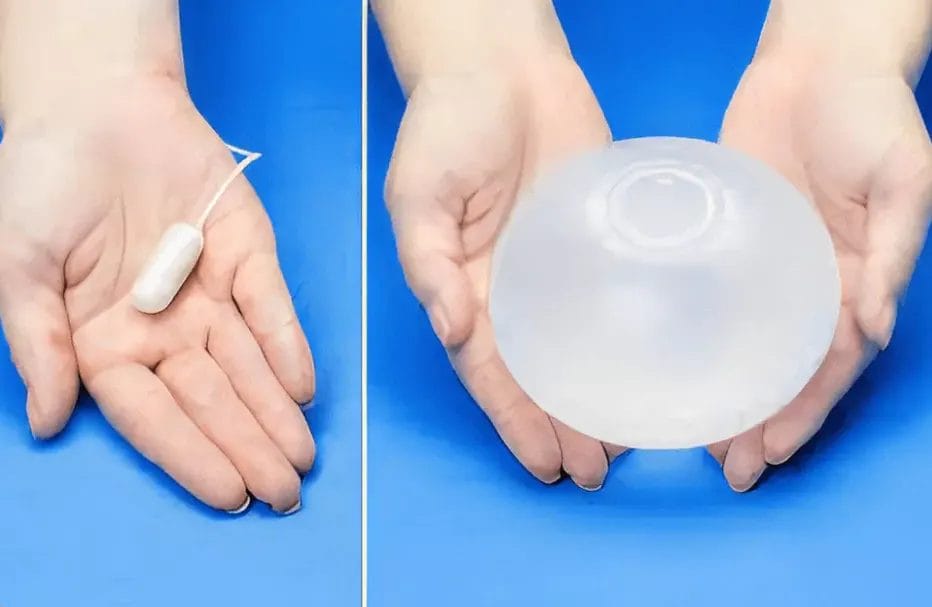 ما الفرق بين الكبسولة الذكية وبالون المعدة ؟