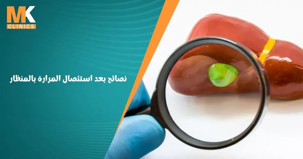 نصائح بعد استئصال المرارة بالمنظار