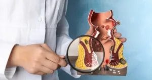 تجربتي مع منظار القولون بدون تخدير 