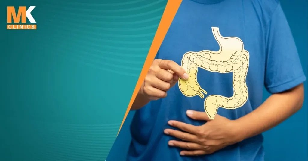 إزالة لحمية القولون بالمنظار