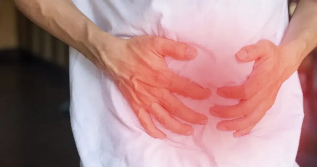 خطوات عملية إزالة لحمية القولون بالمنظار