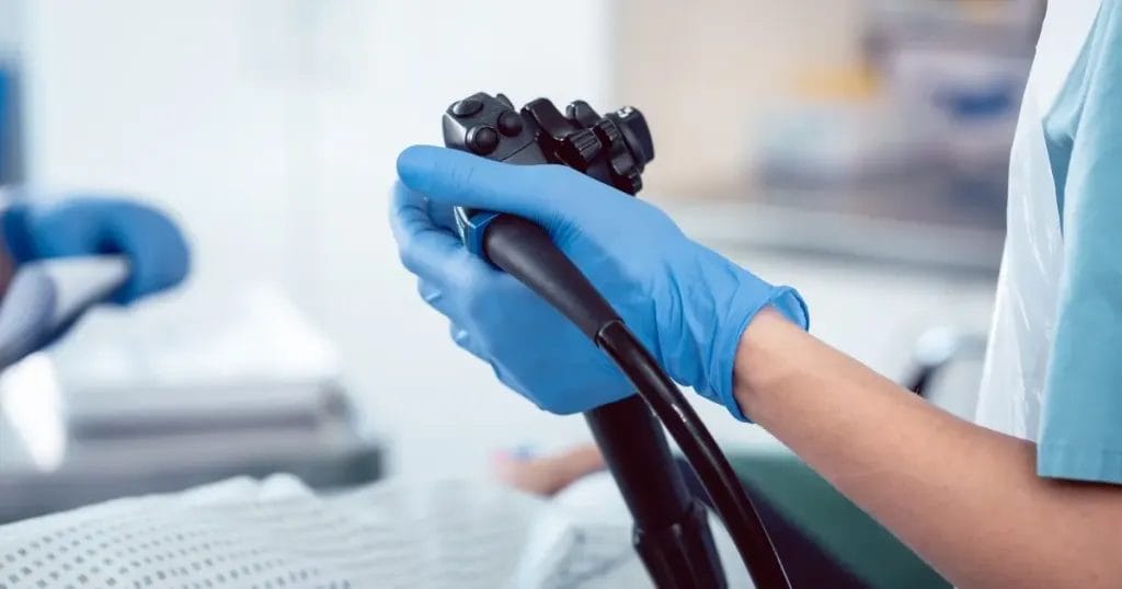 تجربتي مع منظار القولون بدون تخدير