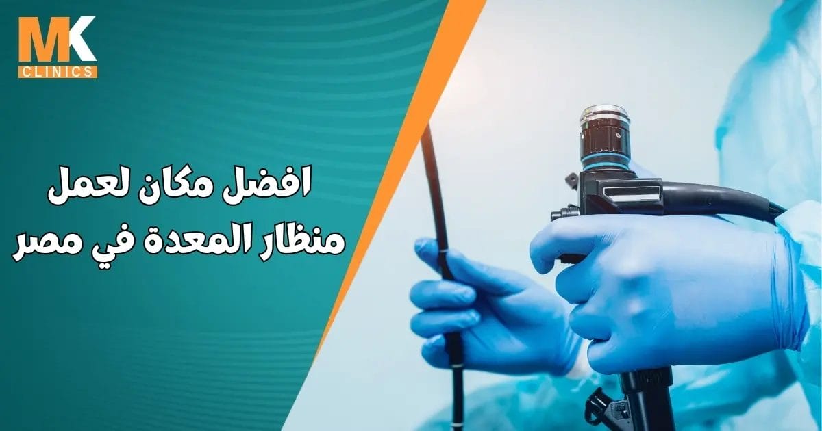 افضل مكان لعمل منظار المعدة في مصر