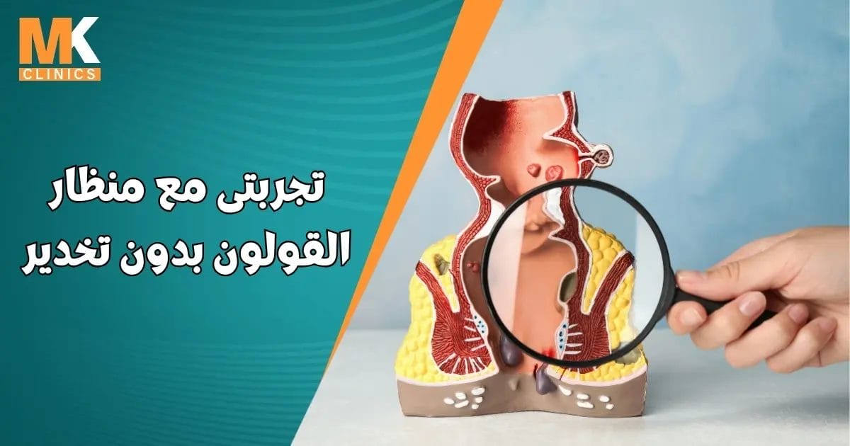 تجربتى مع منظار القولون بدون تخدير