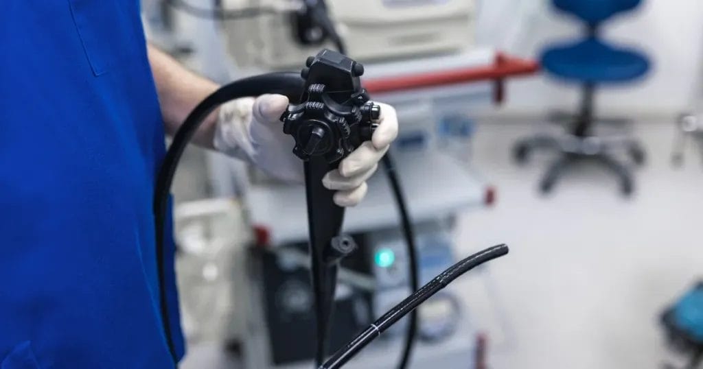 متى يتم اللجوء إلى منظار المعدة