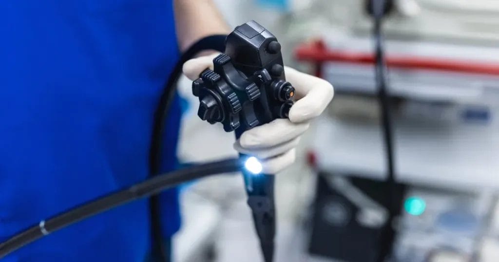 أسباب استخدام منظار المعدة