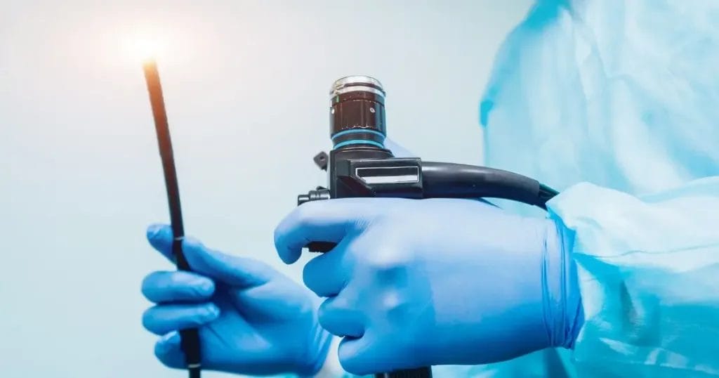 أهم نصائح بعد عملية منظار المعدة