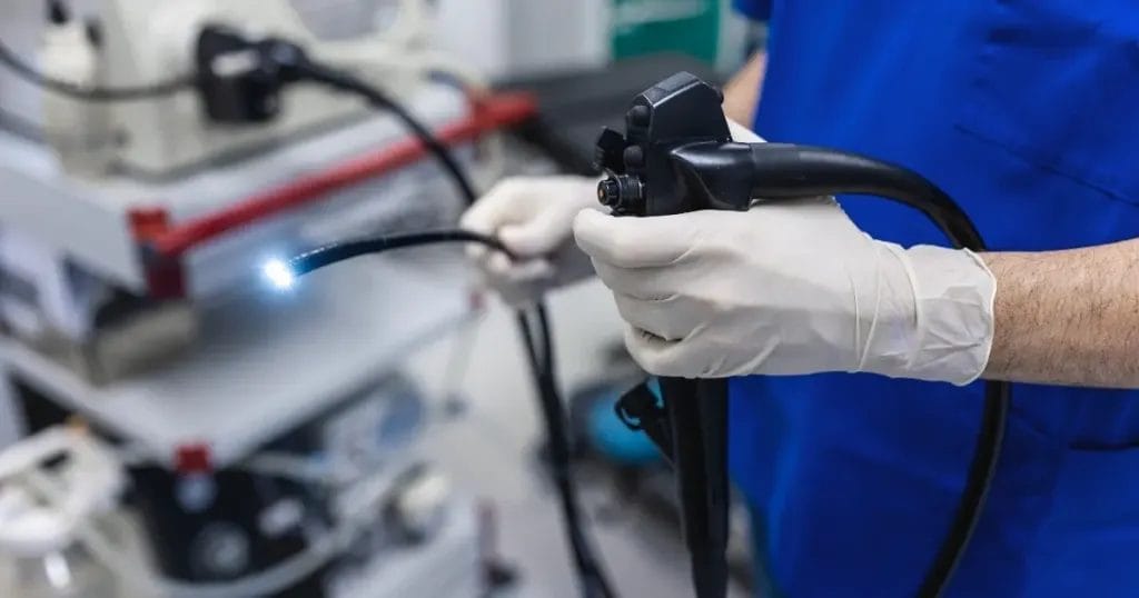 ما هي أسباب إجراء عملية منظار المعدة