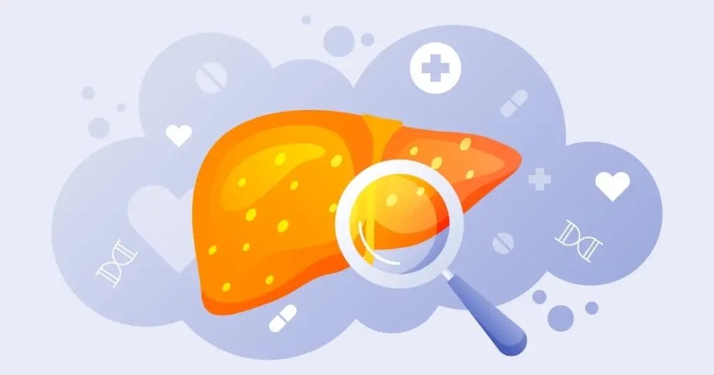 مراحل سرطان الكبد