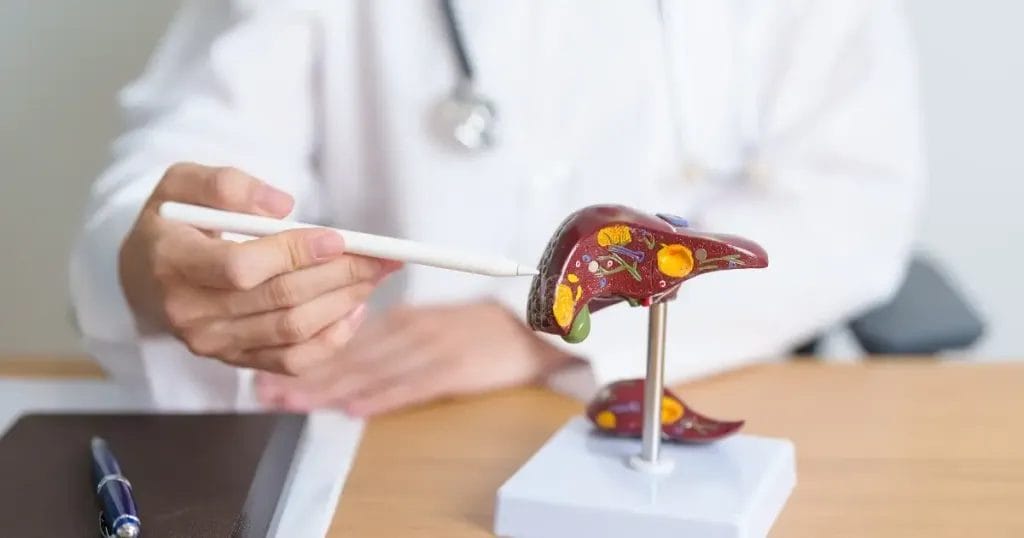 كم يعيش مريض سرطان الكبد بدون علاج