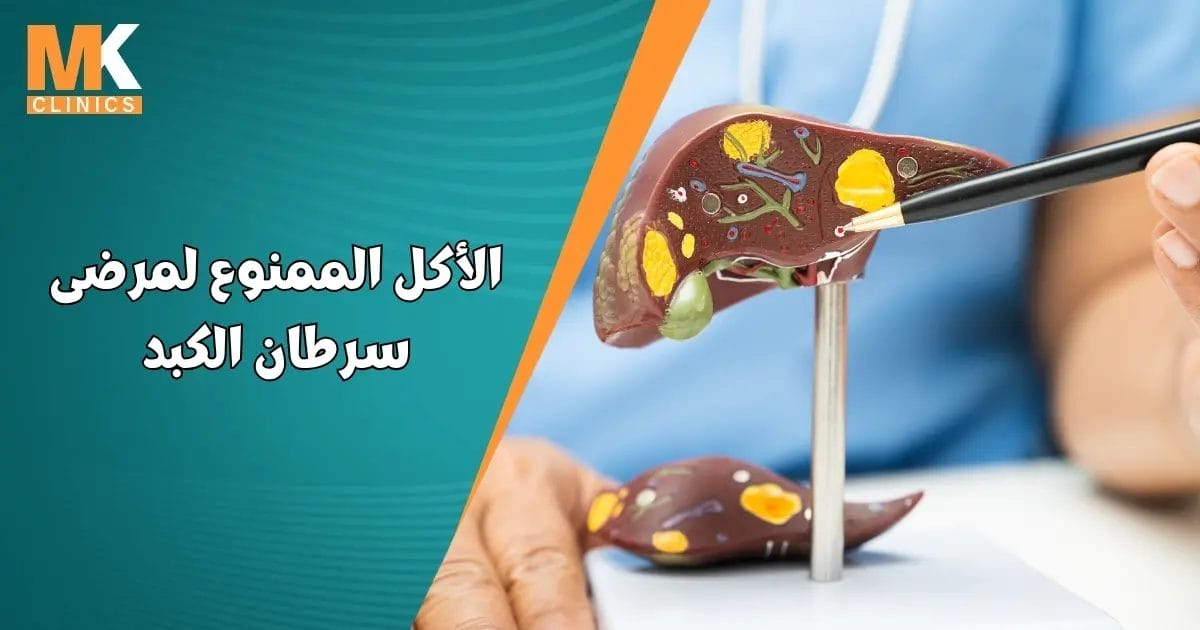 الأكل الممنوع لمرضى سرطان الكبد