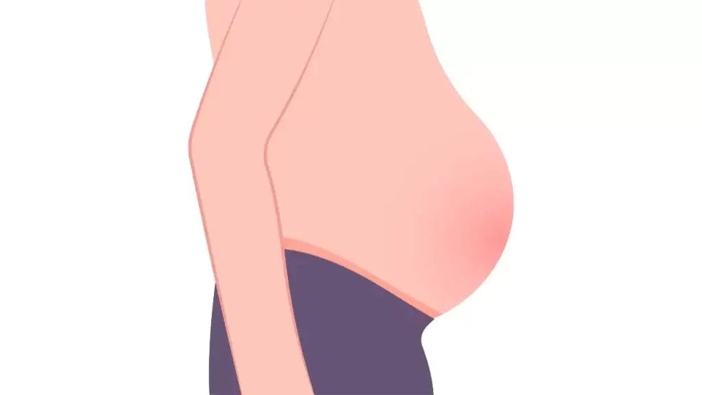 شكل بطن مريض الكبد 