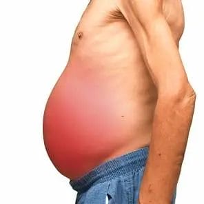 شكل بطن مريض الكبد 