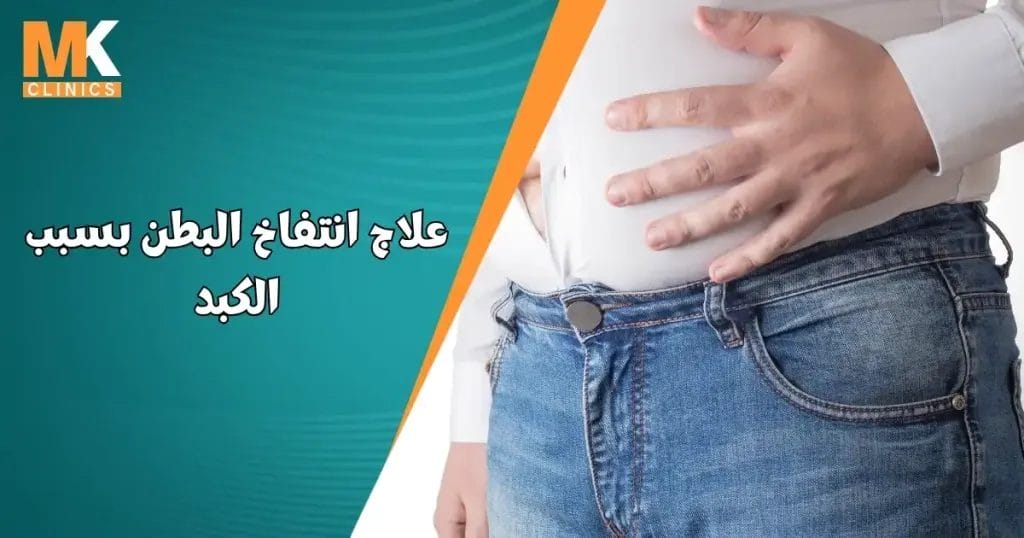 علاج انتفاخ البطن بسبب الكبد