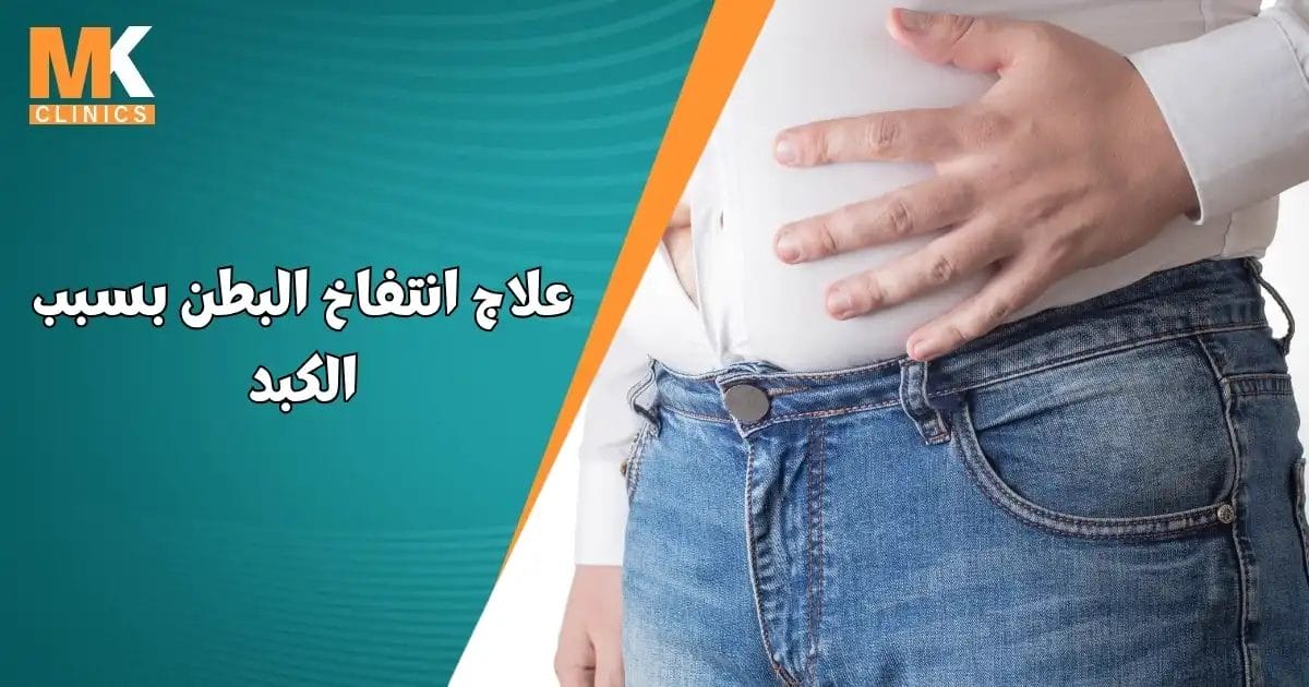 علاج انتفاخ البطن بسبب الكبد