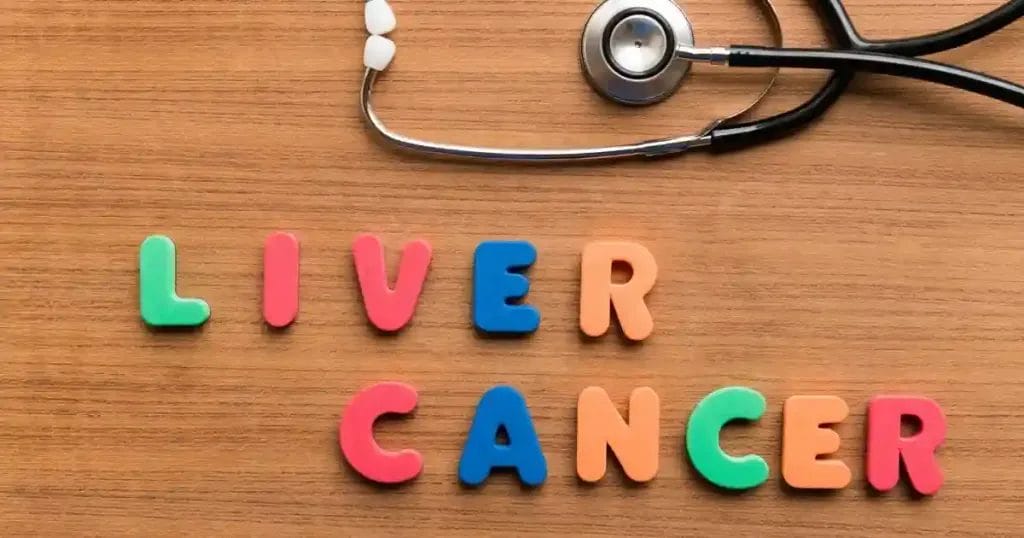 نسبة شفاء مرضى سرطان الكبد