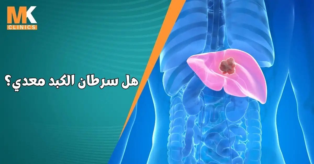 دكتور محمد كريم عاشور 8 هل سرطان الكبد معدي