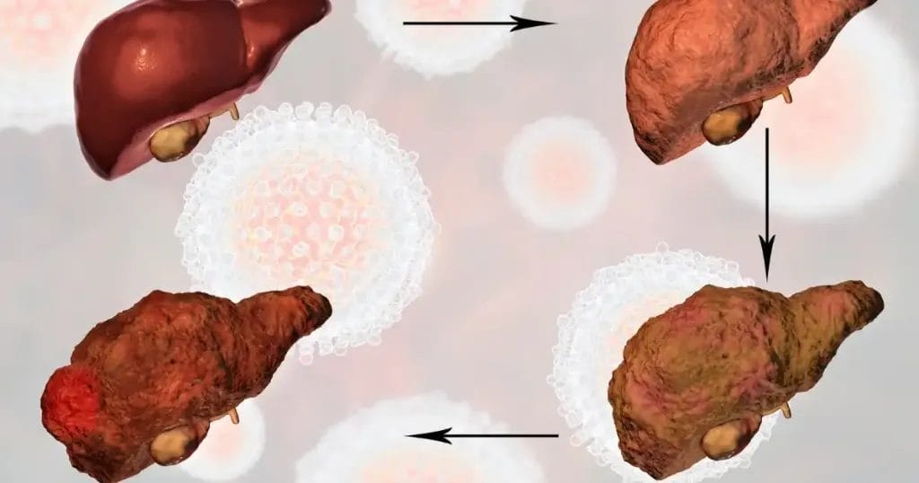 هل هناك عدوى تزيد من خطر الإصابة بالسرطان؟