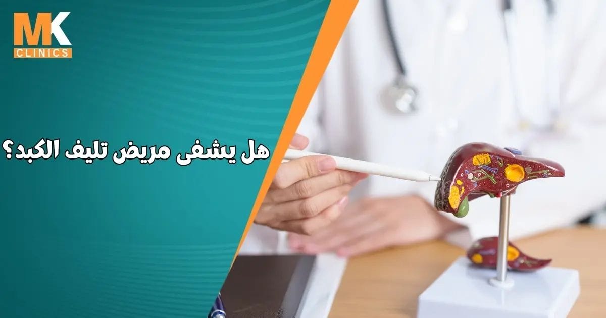 دكتور محمد كريم عاشور 7 هل يشفى مريض تليف الكبد