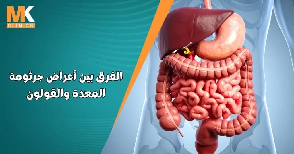 الفرق بين أعراض جرثومة المعدة والقولون