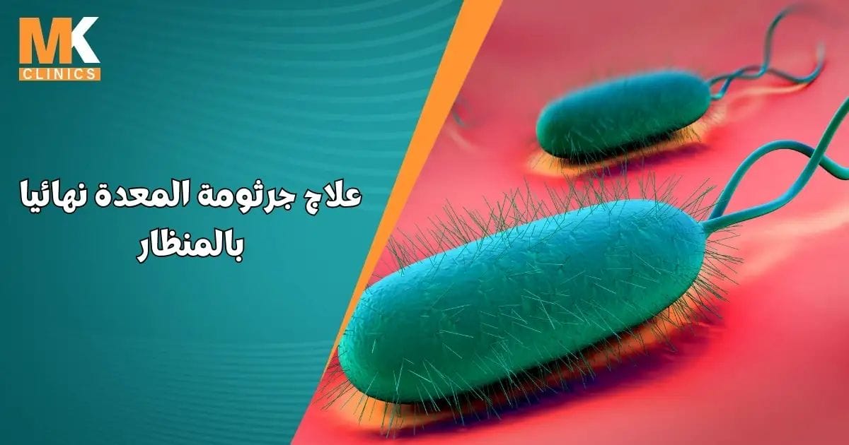 دكتور محمد كريم عاشور 3 علاج جرثومة المعدة نهائيا بالمنظار