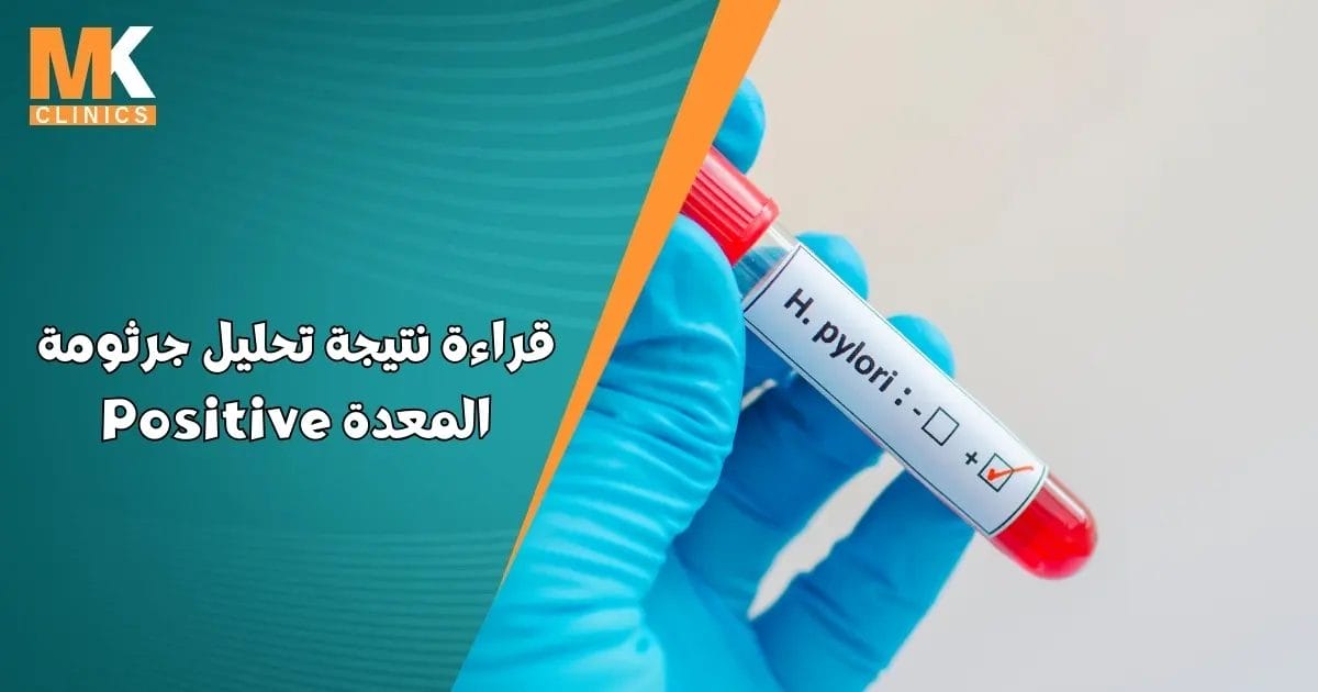 قراءة نتيجة تحليل جرثومة المعدة Positive